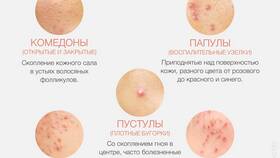 Чем отличаются подписки: основные виды и характеристики в ТНК